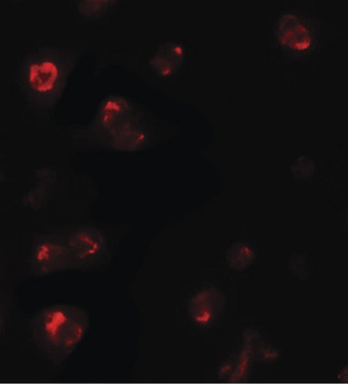 TBX21/T-bet Antibody