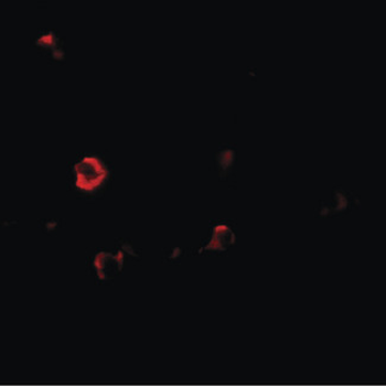 IL1RL2 Antibody