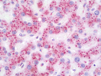 GLB1/Beta-Galactosidase Antibody