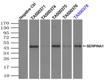 SERPINA1 / Alpha 1 Antitrypsin Antibody (clone 11G2)