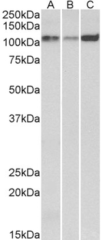 ATP2A2/SERCA2 Antibody