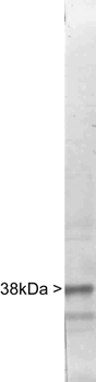 CSNK1A1/CK1 Alpha Antibody