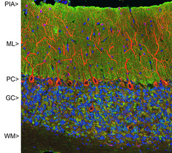 VILIP/VSNL1 Antibody