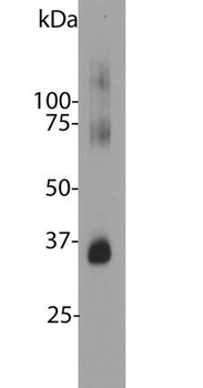 Rhodopsin/RHO Antibody