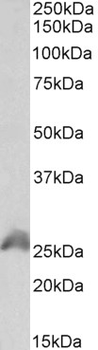 HOXB6 Antibody
