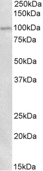 ENPP2/Autotaxin Antibody