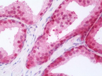 RARG/RAR-Gamma Antibody