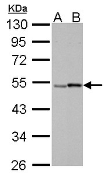 RARG/RAR-Gamma Antibody