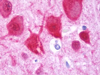 HOMER1/Homer 1 Antibody