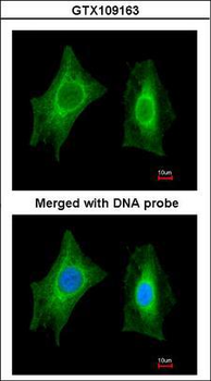PSPH Antibody