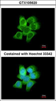 DDH/AKR1C1 Antibody