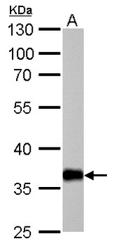DDH/AKR1C1 Antibody