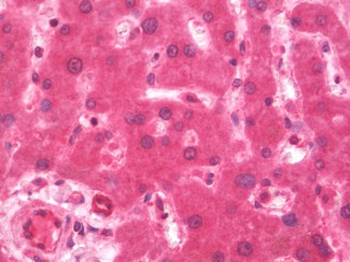 AZIN2 / Antizyme Inhibitor 2 Antibody (Internal)