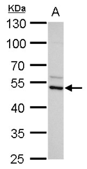AZIN2 / Antizyme Inhibitor 2 Antibody (Internal)