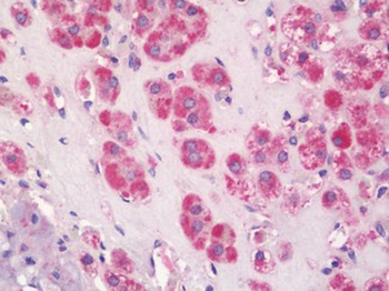 SLC16A2/MCT8 Antibody