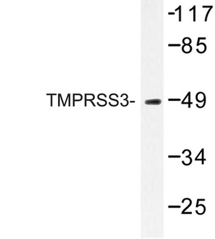 TMPRSS3 Antibody