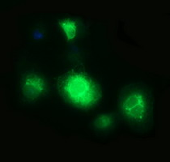 CD163 Antibody
