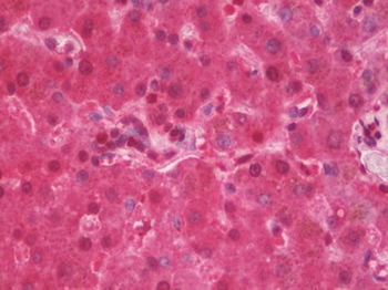 GLB1/Beta-Galactosidase Antibody