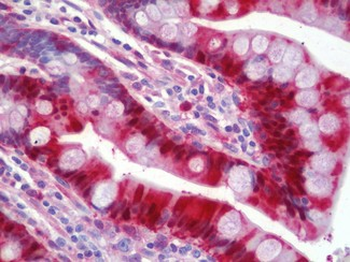 LGALS3/Galectin 3 Antibody