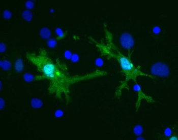 LGALS3/Galectin 3 Antibody