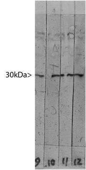 LGALS3/Galectin 3 Antibody