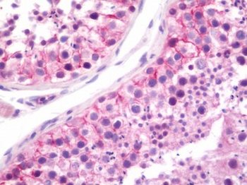 TJP1/ZO-1 Antibody