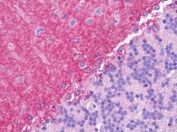 JAG1/Jagged 1 Antibody