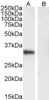 CD20 Antibody