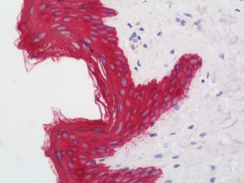 KRT19/CK19/Cytokeratin 19 Antibody