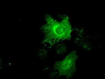 KRT19/CK19/Cytokeratin 19 Antibody