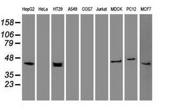KRT19/CK19/Cytokeratin 19 Antibody