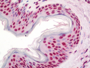 DDIT3/CHOP Antibody