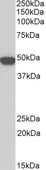 KRT18/CK18/Cytokeratin 18 Antibody