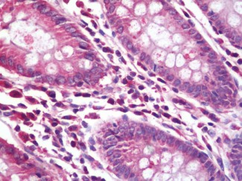 RPL5/Ribosomal Protein L5 Antibody