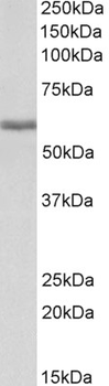 FGB/Fibrinogen Beta Chain Antibody