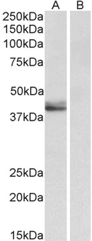 SERPINB1 Antibody