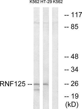 RNF125/TRAC-1 Antibody