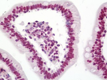 SNAI1/SNAIL-1 Antibody