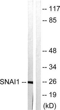 SNAI1/SNAIL-1 Antibody