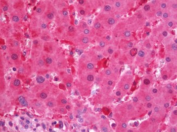 FTL/Ferritin Light Chain Antibody
