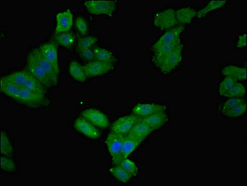 FTL/Ferritin Light Chain Antibody