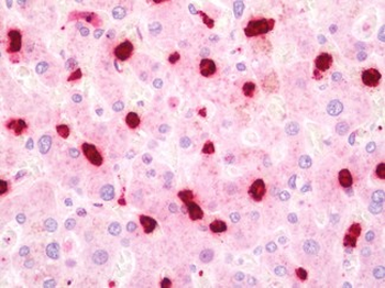 MPO/Myeloperoxidase Antibody