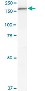 MPO/Myeloperoxidase Antibody