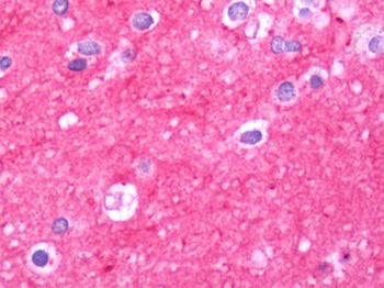 THY1/CD90 Antibody
