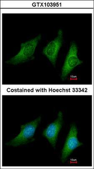 CD55 Antibody