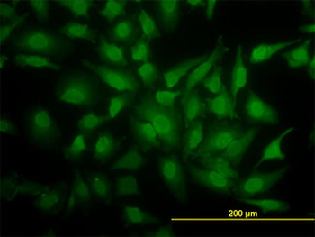 YBX1/YB1 Antibody