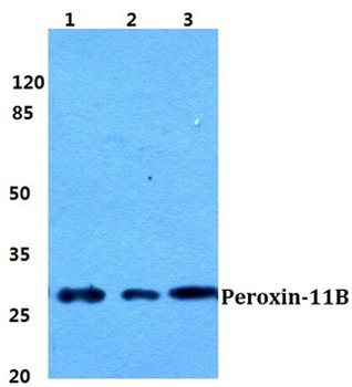 PEX11B Antibody