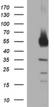 TH/Tyrosine Hydroxylase Antibody