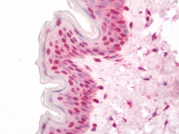 PRX-1/PRRX1 Antibody