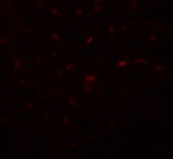 TRB3/TRIB3 Antibody